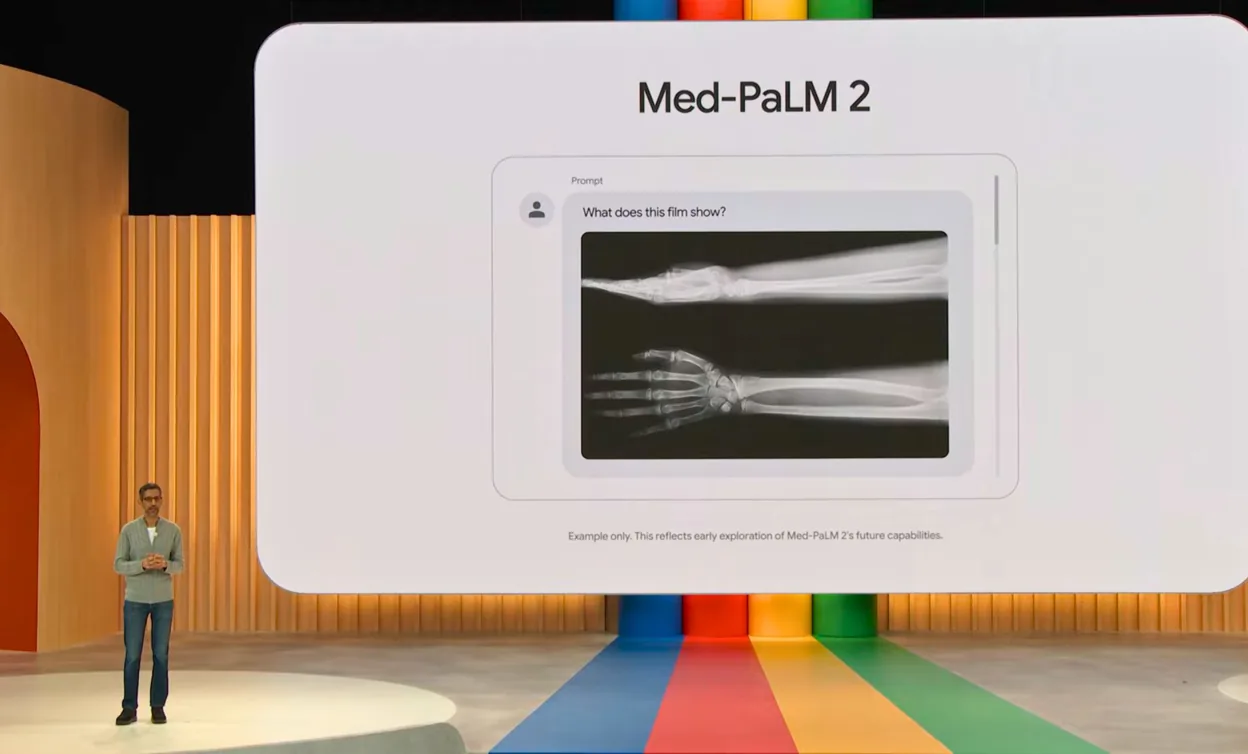 Google Med-Palm 2